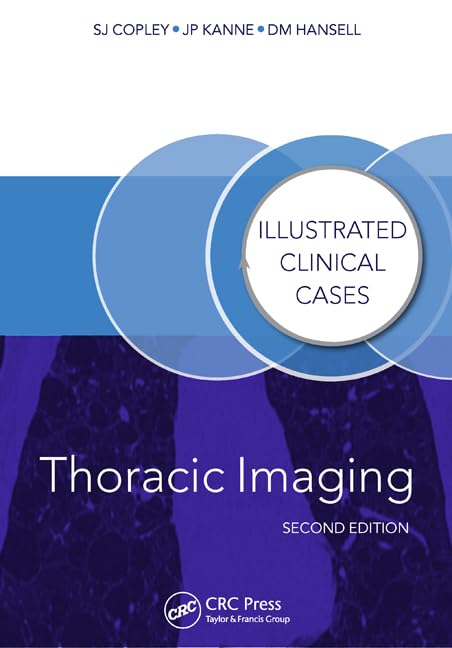 Thoracic Imaging: Illustrated Clinical Cases, Second Edition